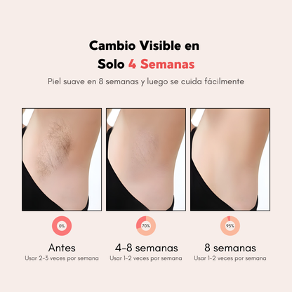 IPL Hair Reduction Device