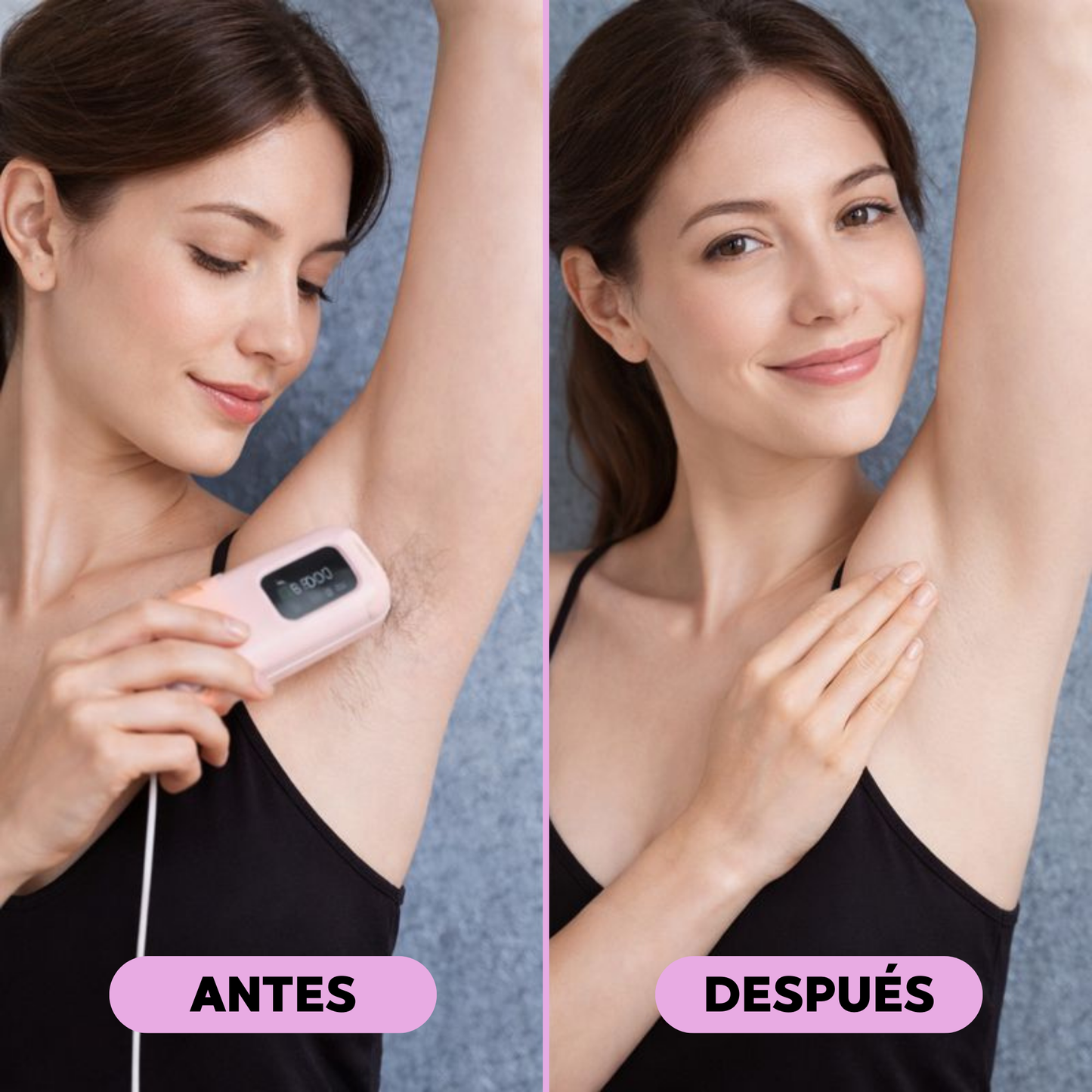 IPL Hair Reduction Device