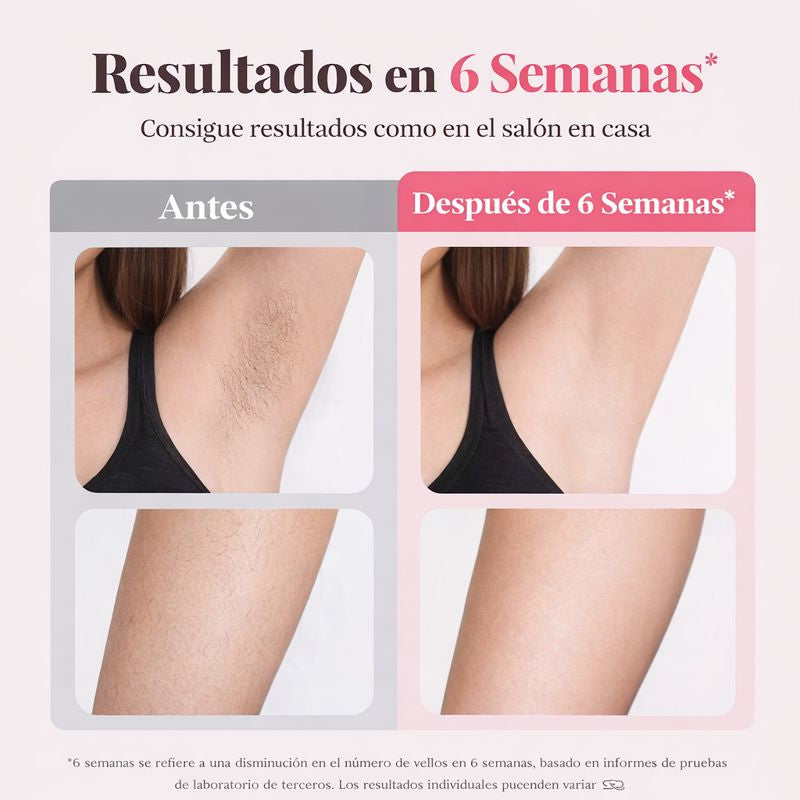 IPL Hair Reduction Device