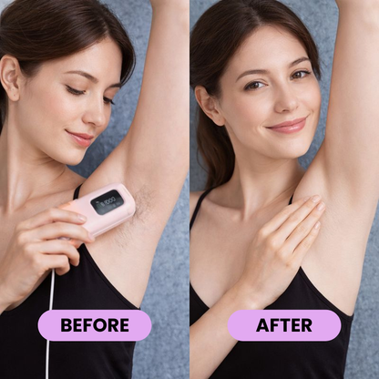 IPL Hair Reduction Device